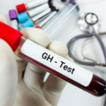 How Do Patient Characteristics Influence GH Stimulation Test?