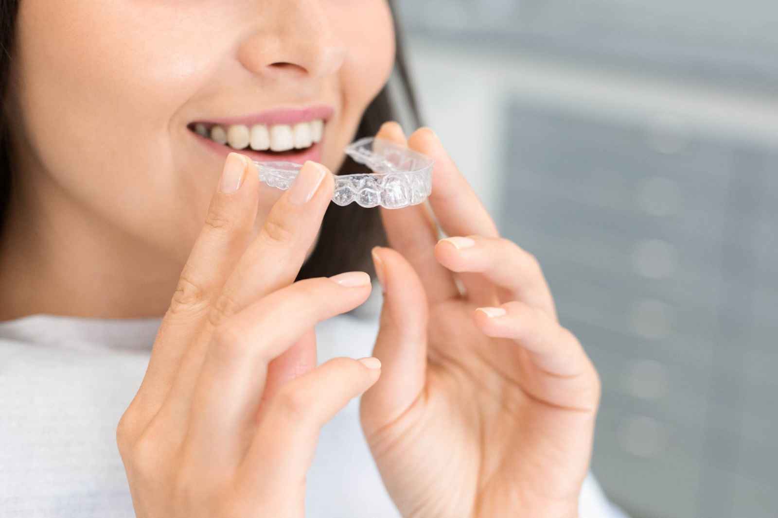 The Science of Clear Aligners: Achieving an Ideal Dental Alignment