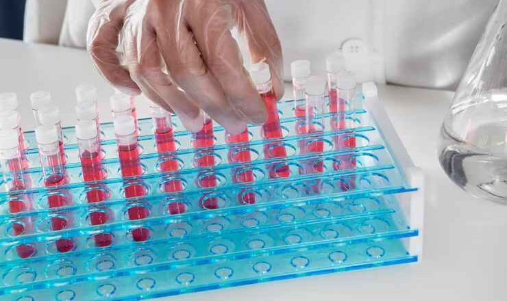 What Is the Thromboxane A2 ELISA Kit Used For?